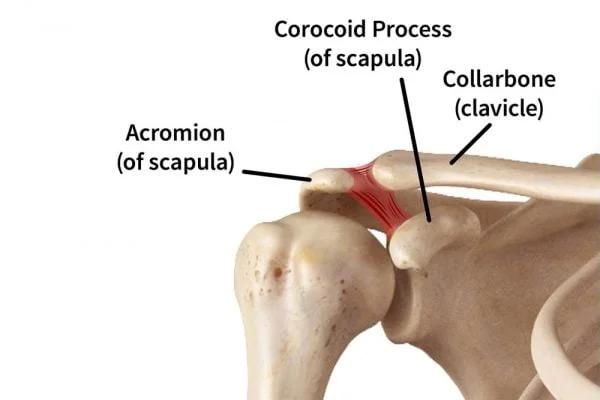 Clavicle-Fractures Workplace Injuries and Fatalities on Construction Sites