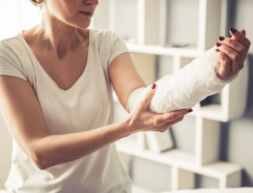 Broken Arm: Treatment and Recovery