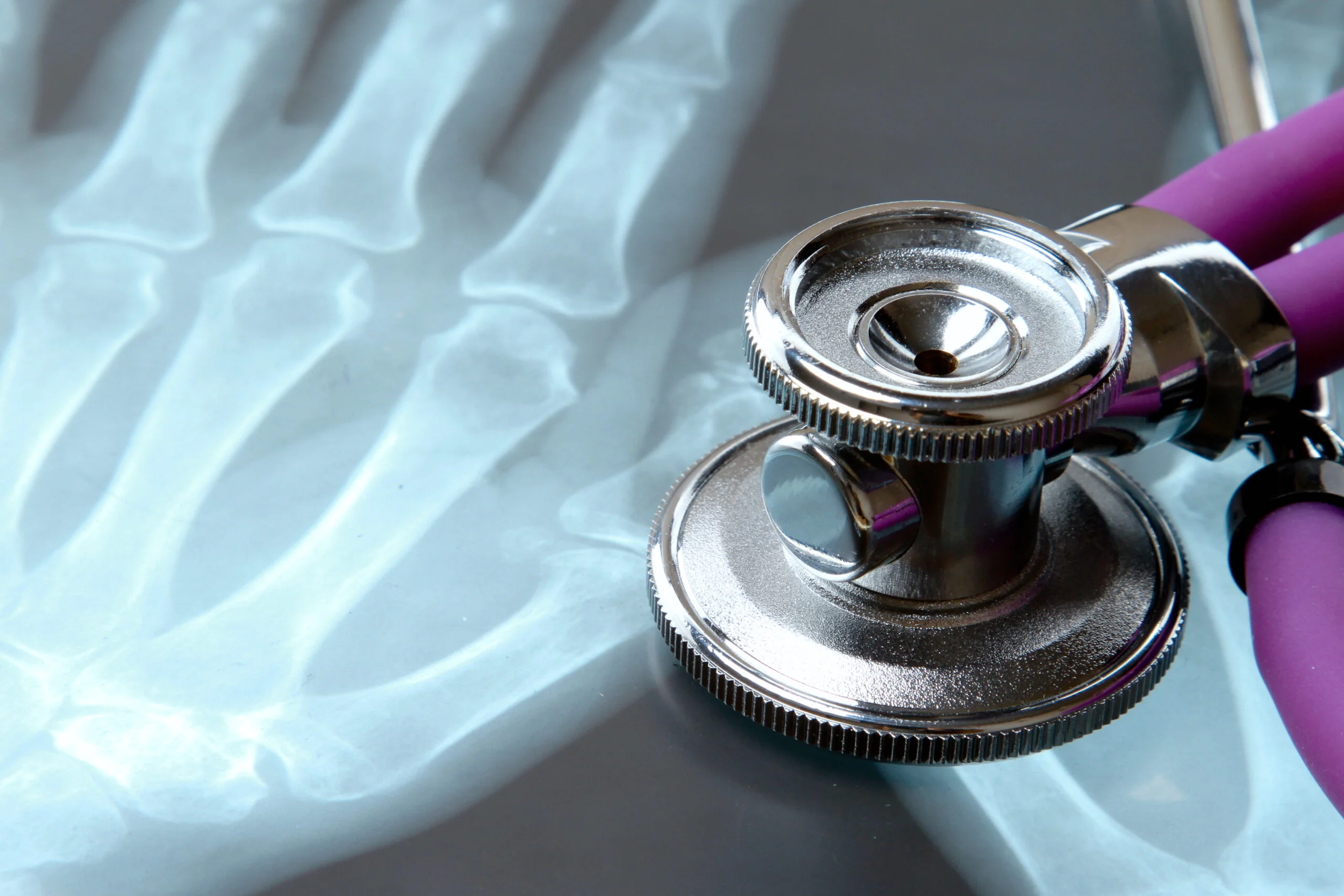 X-ray and stethoscope.