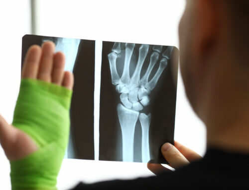 How Untreated Fractures Can Affect Long-Term Health