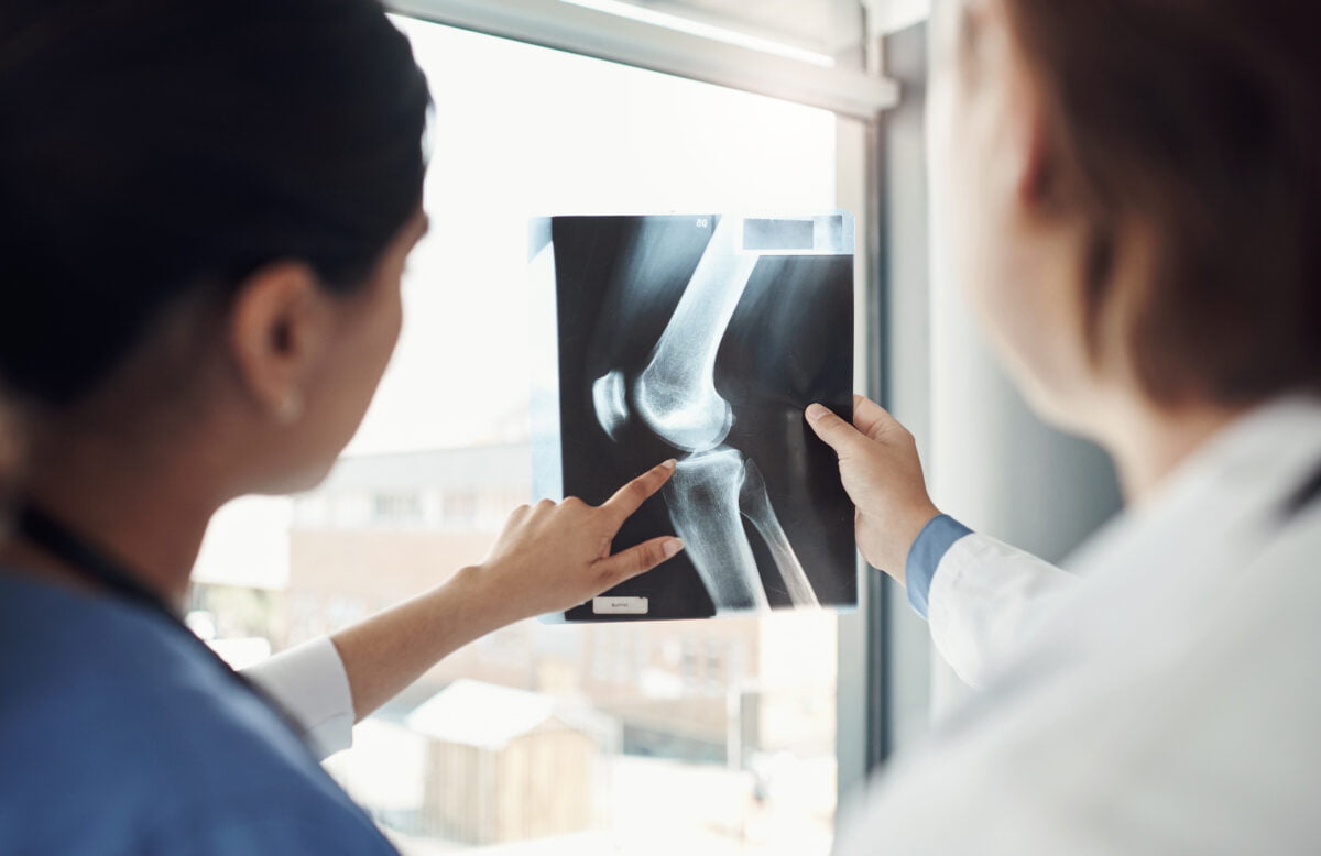 Understanding the 5 Types of Bone Fractures
