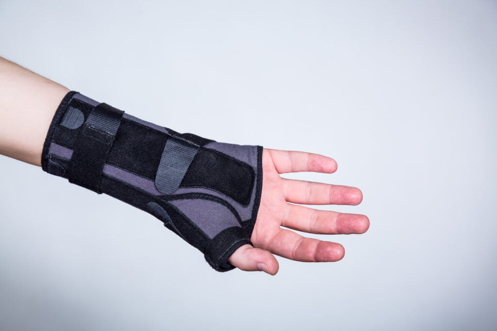 Wrist Fractures