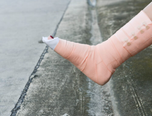 Preventing Foot Fractures: Strategies for Maintaining Healthy Feet and Ankles