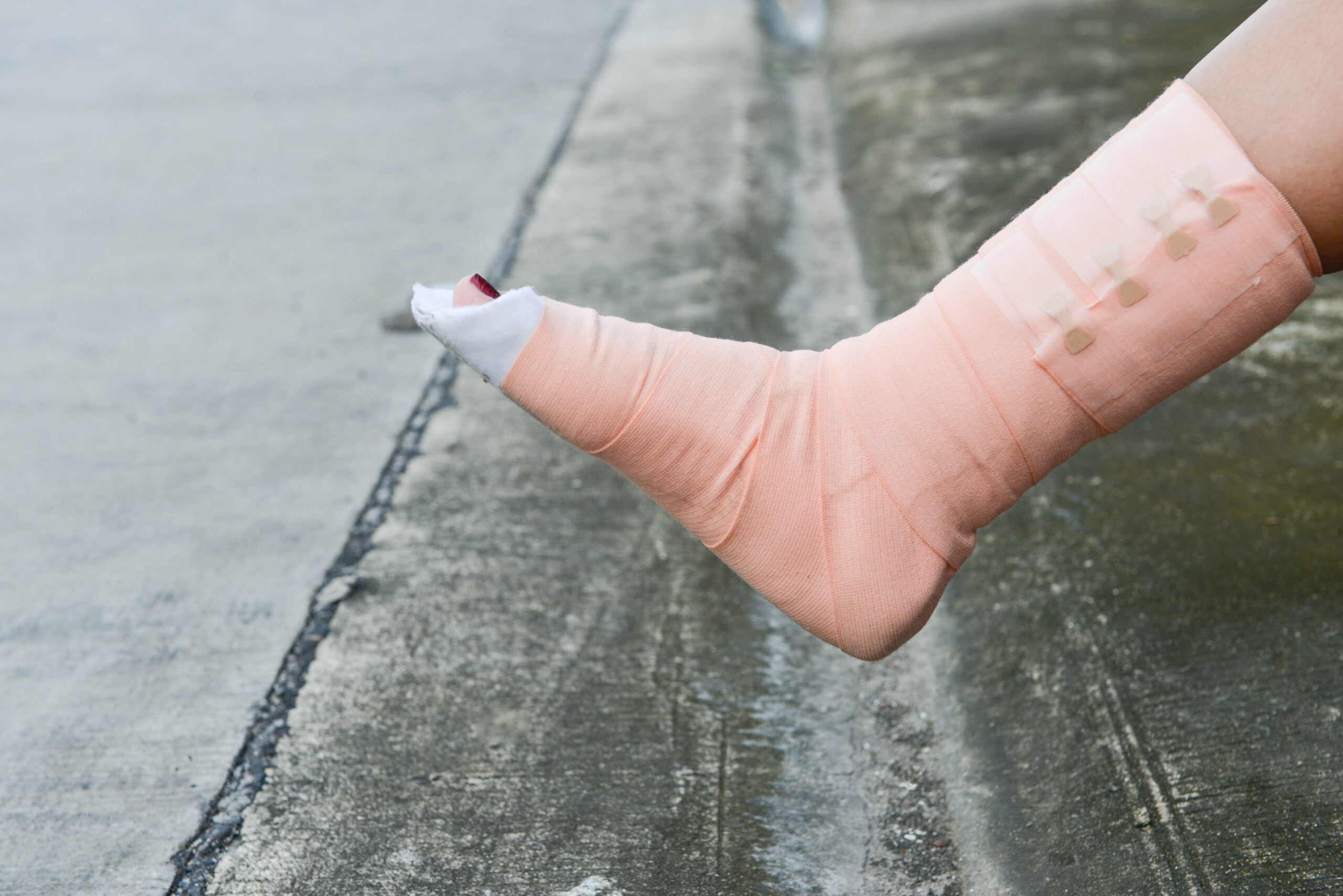 Preventing Foot Fractures