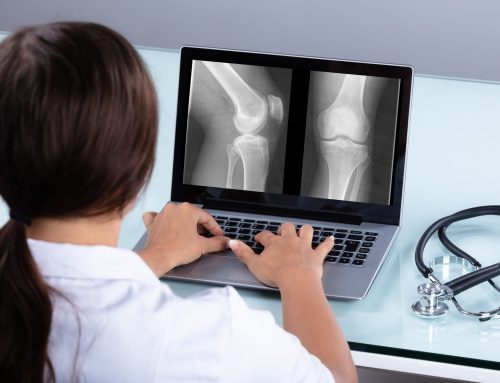 When to Get an X-ray for a Bone Fracture: Signs You Shouldn’t Ignore