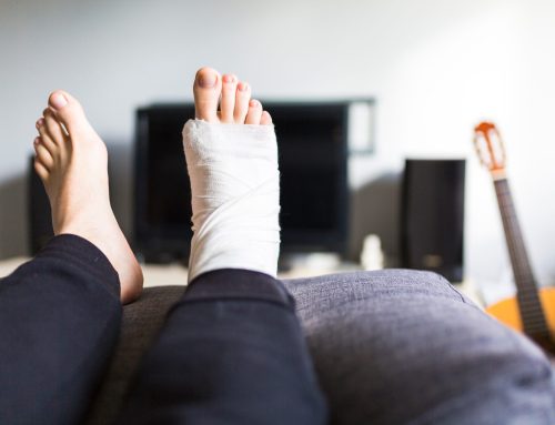 What Is a Pott’s Fracture? Understanding the Injury and How to Heal Effectively