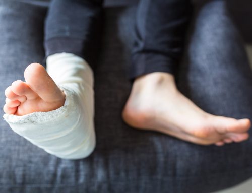 Sleeping with a Broken Ankle: Positioning, Pillows, and What to Avoid
