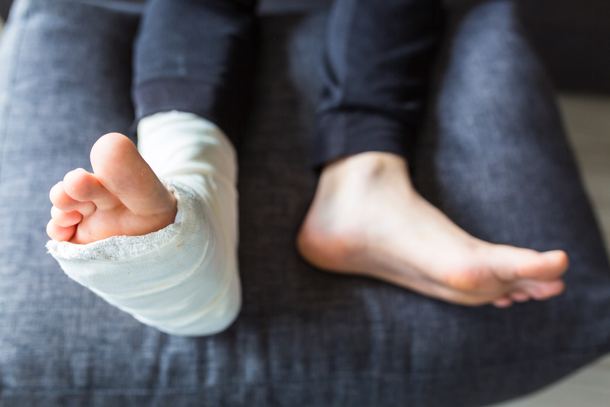 Sleeping with a Broken Ankle: Positioning, Pillows, and What to Avoid