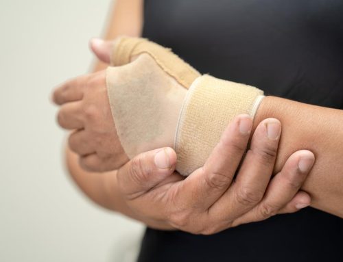 Protected: The Hidden Cost of a Slow-Healing Fracture: Time, Money, and Mobility