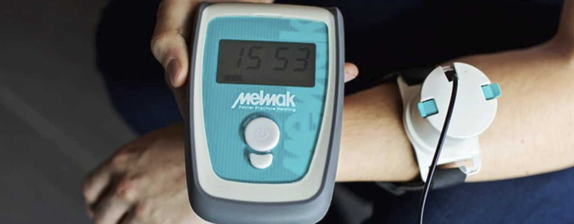melmack device being used on a fracture 